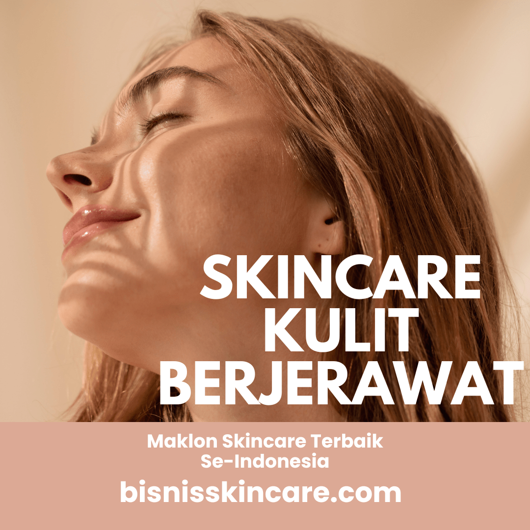 Bingung Cari Skincare untuk Kulit Berjerawat? Ini Rekomendasi yang